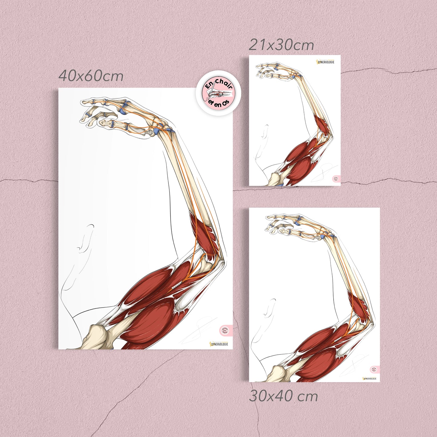 anatomie nerf radial - poster anatomique du bras