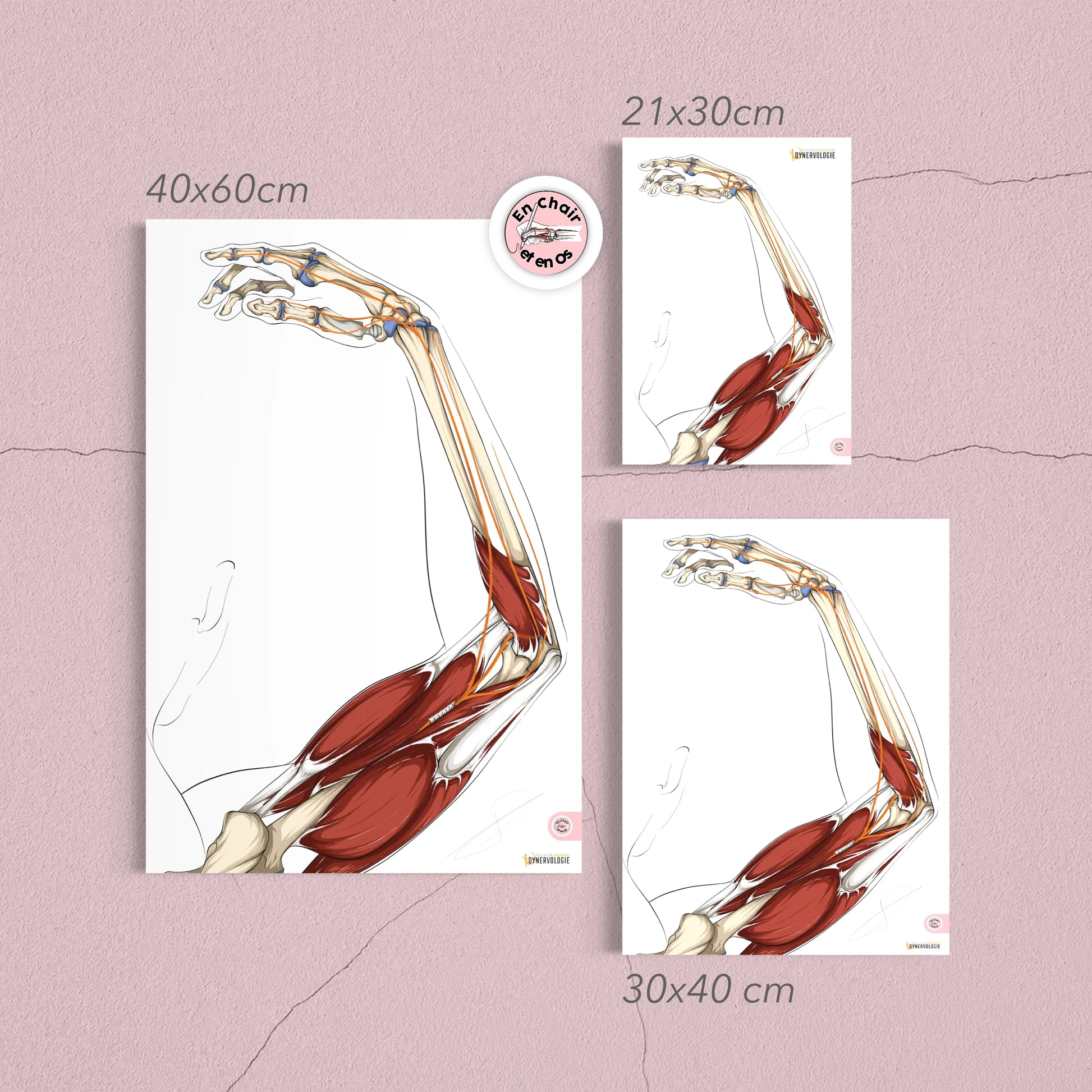 anatomie nerf radial - poster anatomique du bras