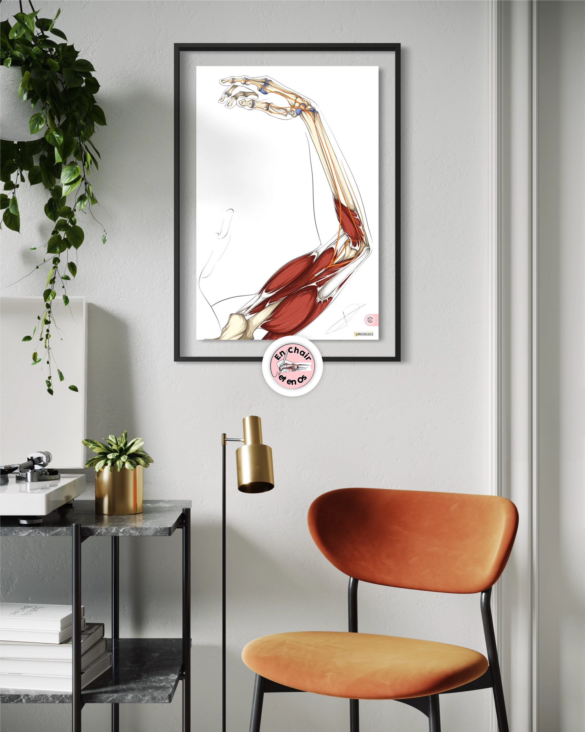 anatomie nerf radial - poster anatomique du bras